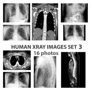 Imágenes de rayos X para carteles, descarga digital de rayos X, imágenes prediseñadas de huesos, collage médico, regalo para el médico, decoración del consultorio del médico, juego 3