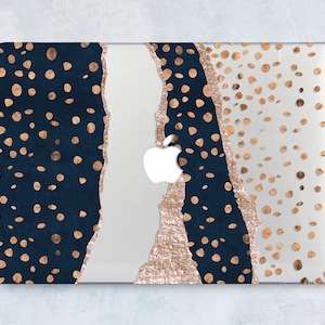 Polka Dot Macbook Pro Case 16 Inch 2018 Macbook Air 13 Inch Case Gold Dots Macbook Pro Case 13 Inch 15-Inch Macbook Pro Case LD0373