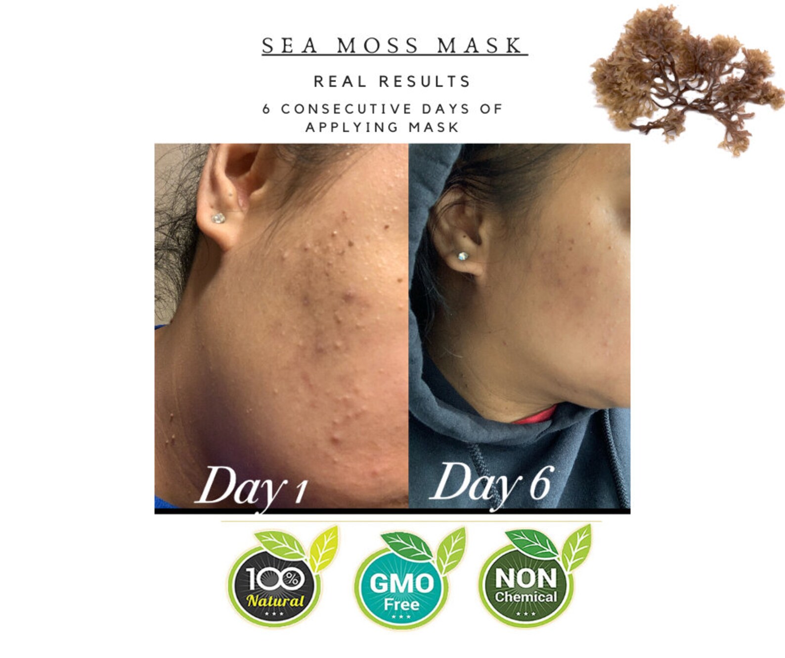 Sea Moss Facial Sheet Mask Bundle 5 Masks Etsy