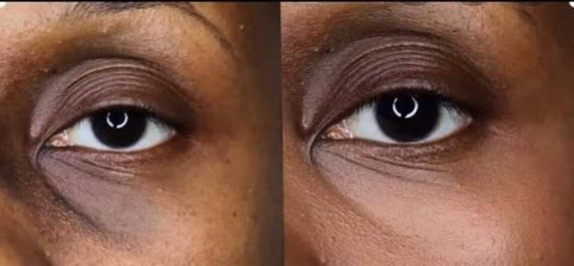 Coo Coo for Cucumber Eye Combo Puffiness Remover Eye Bag Etsy