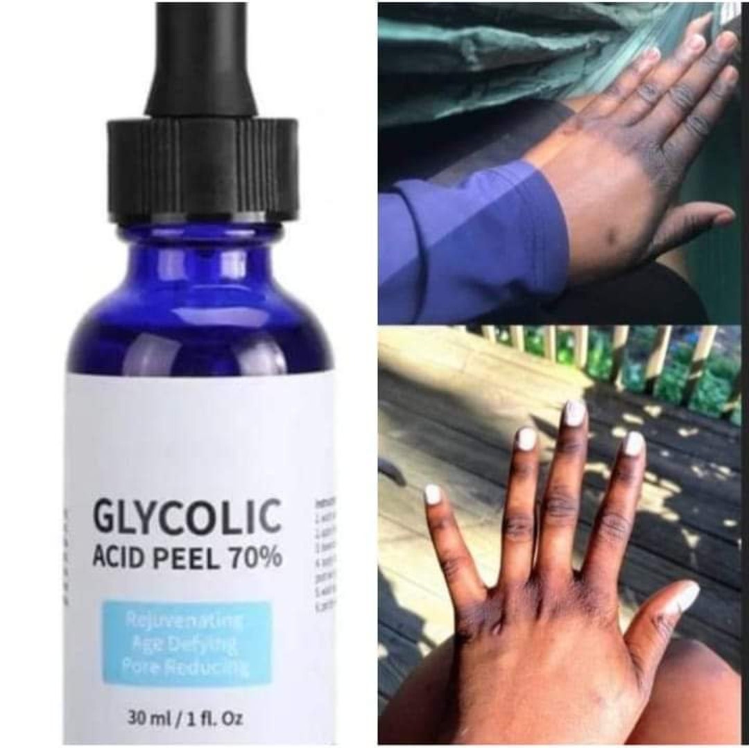 Glycolic Acid & Lactic Acid Concentrated Peel Serum , Knuckle Serum