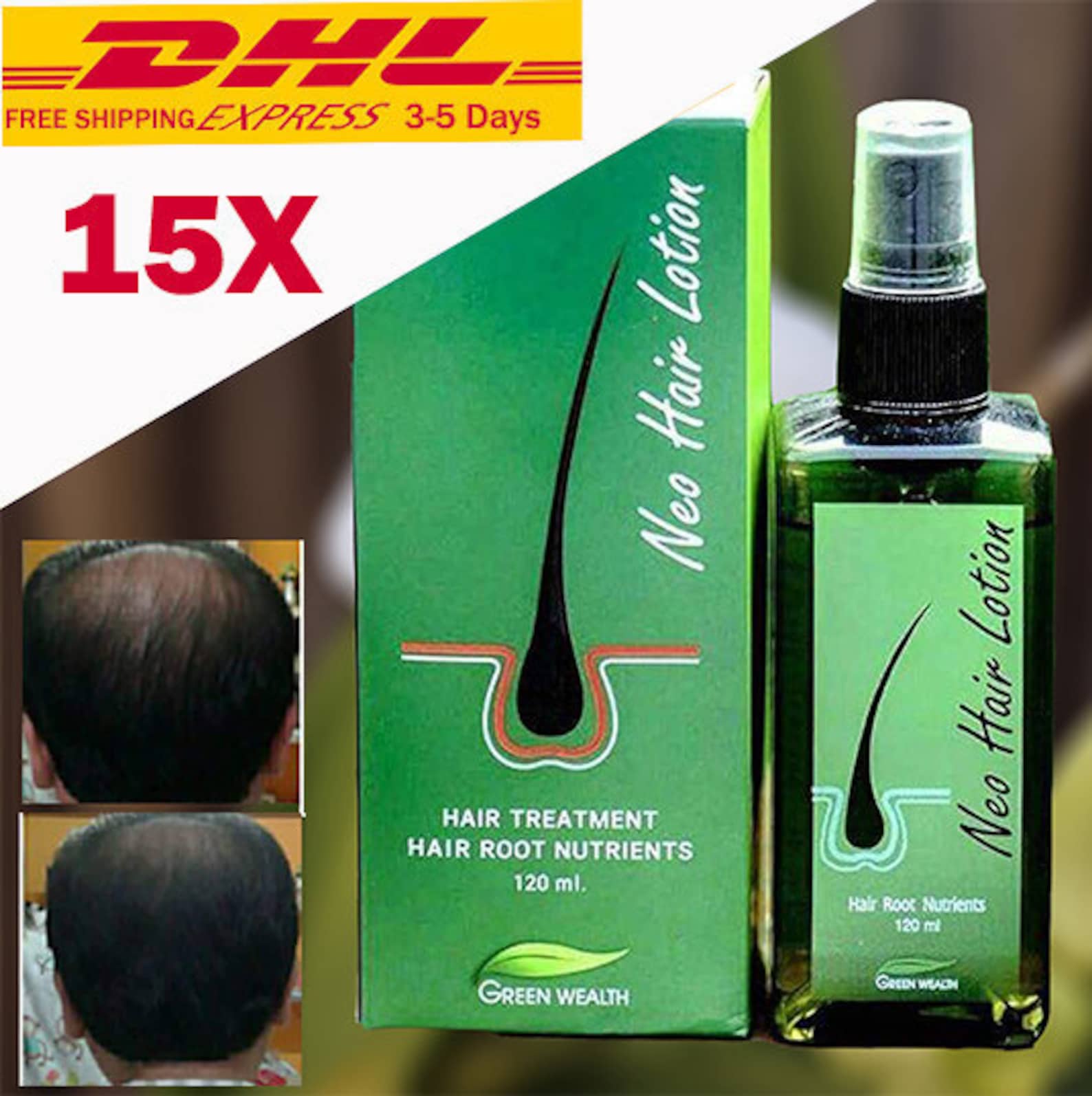 15X NEO Hair Lotion Root Treatment Nutrients Longer 120 Etsy