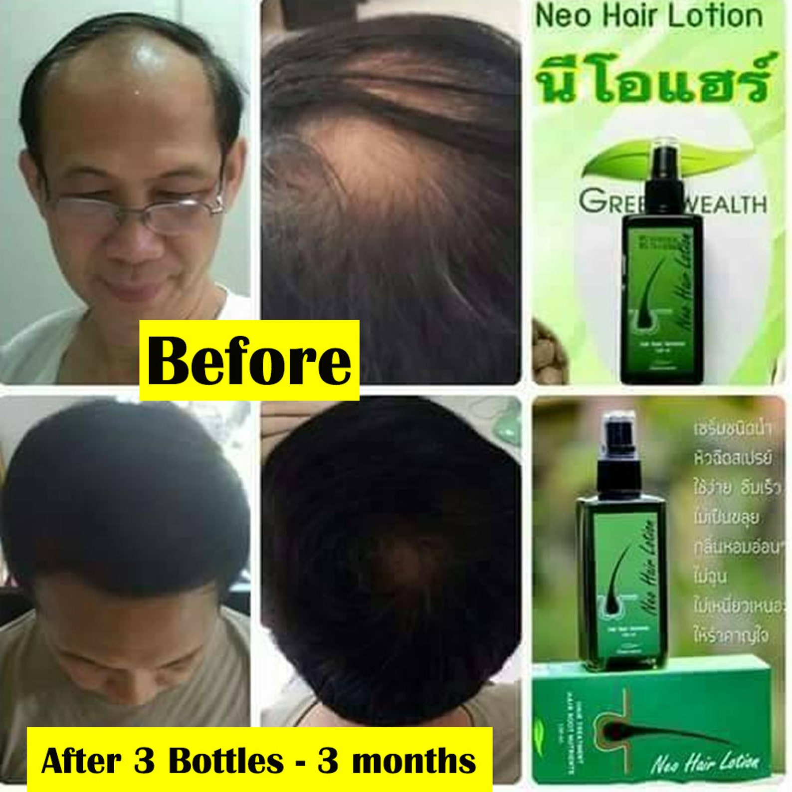 NEO Hair Lotion Root Treatment Nutrients Longer 120 Ml.green Etsy