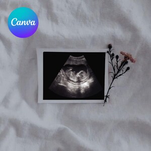 Modèle floral minimaliste pour faire-part de grossesse, carte de vœux pour bébé avec photo, faire-part de naissance numérique CARRÉ