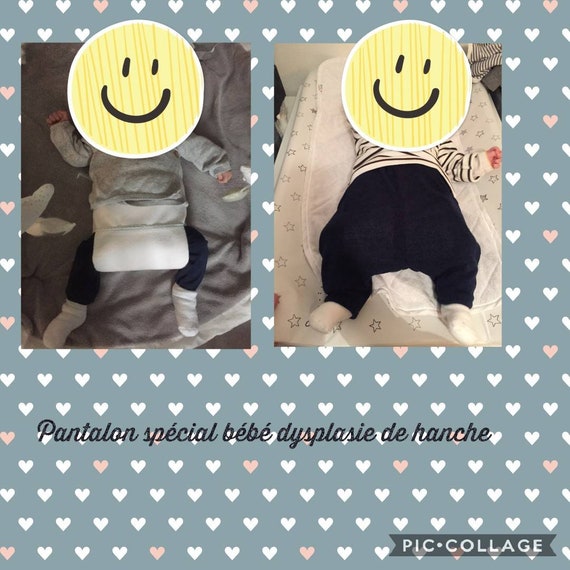 Special Baby Hip Dysphasia Pants Etsy