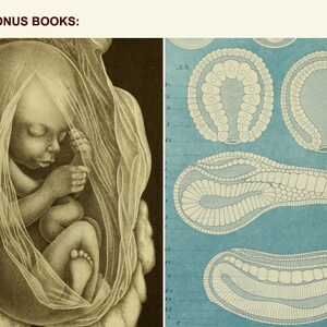 May include: A black and white illustration of a fetus in the womb. The image shows the fetus in a curled position with its arms and legs crossed. The image is from a medical textbook.