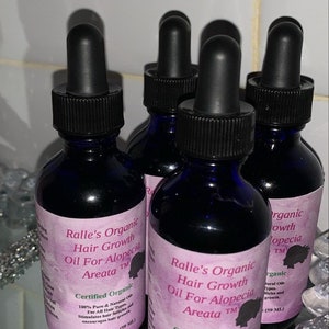 Ralle’s Organic Hair Growth Oil For Alopecia Areata
