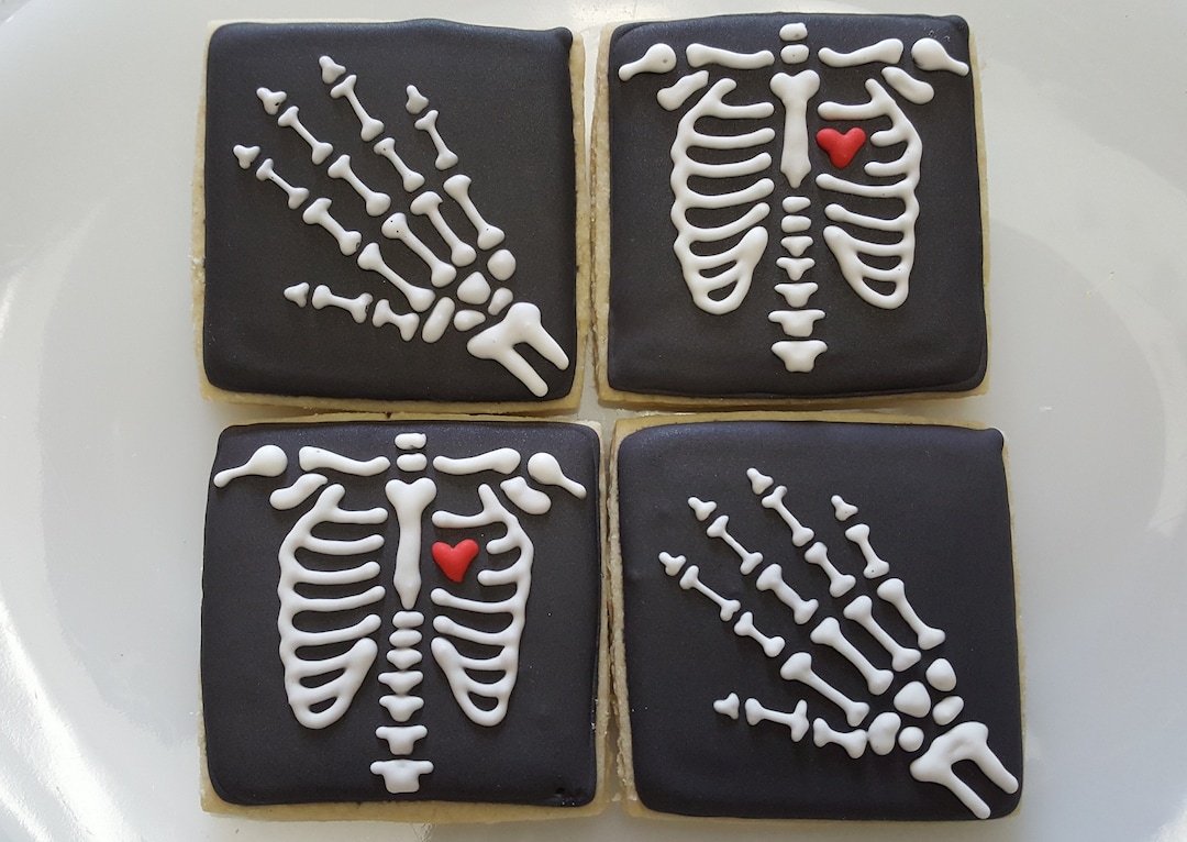 Xray Bone Radiology Party Cookies Etsy