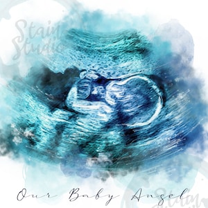 Ultrasound Portrait, Baby Scan Keepsake, Family Portrait, Personalized Sonogram Painting in Watercolor, Pregnancy Drawing from Photo