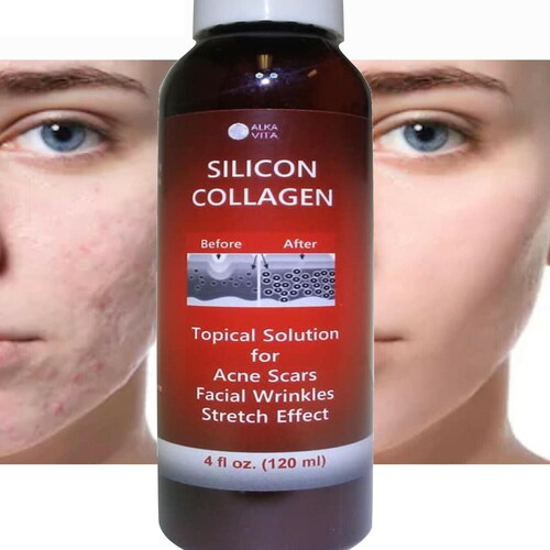 Acne Skin Scars Silicon & Collagen Gel for Indented Rolling Etsy