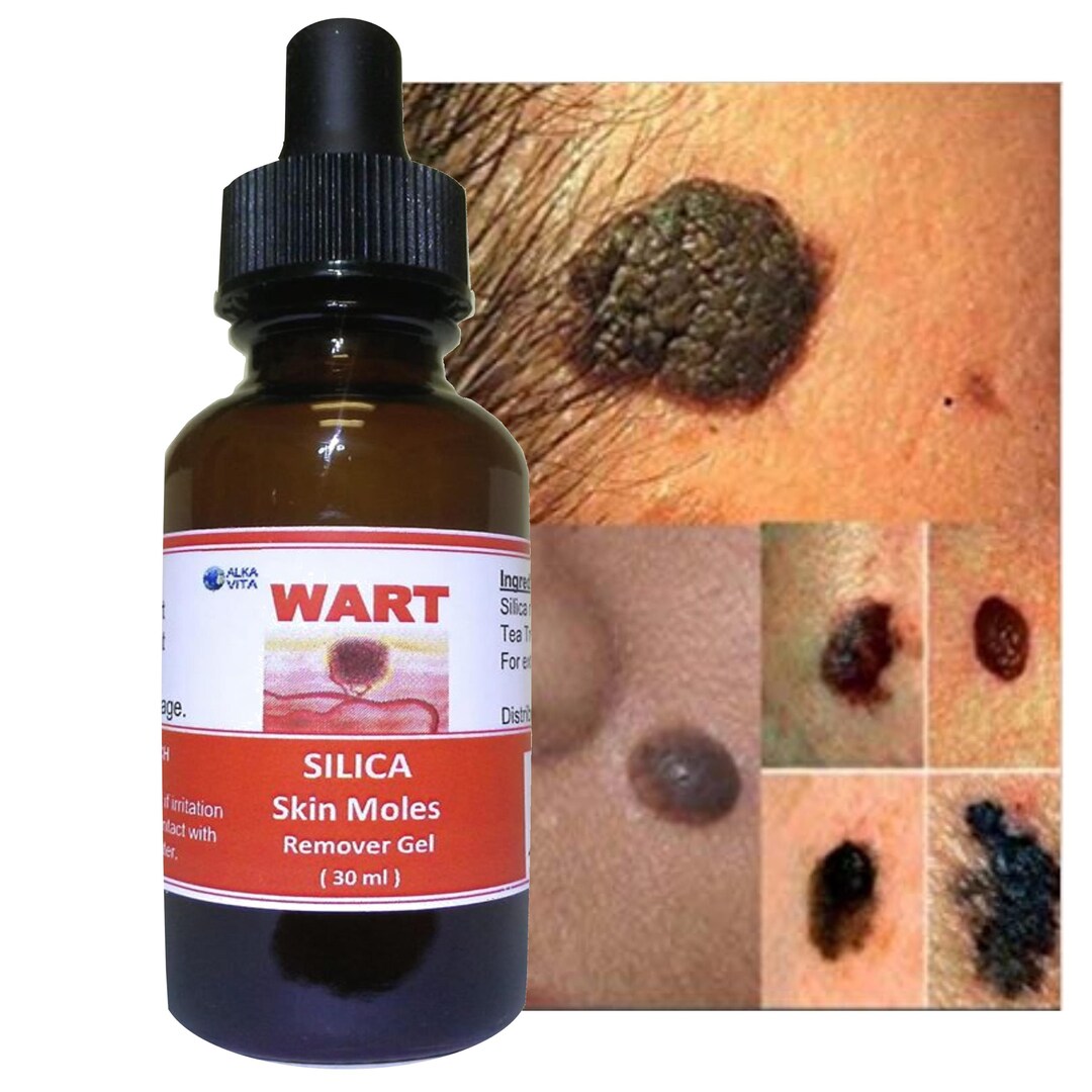 Skin Tag Wart Moles Removal Silica Gel Dryer Effect Not Etsy