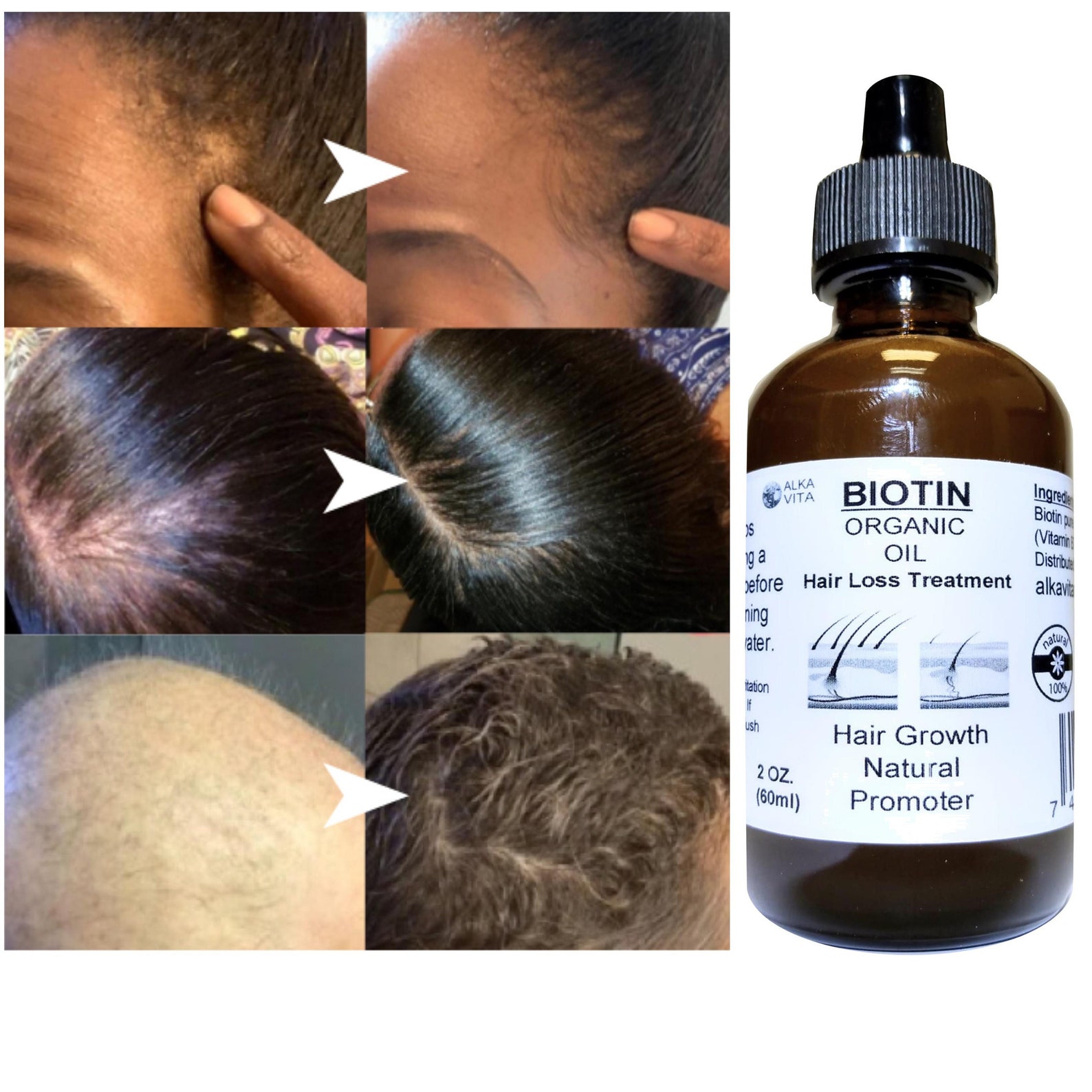 Biotin Hair Loss Growth Promoter Organic Oil & Silica Infused Etsy