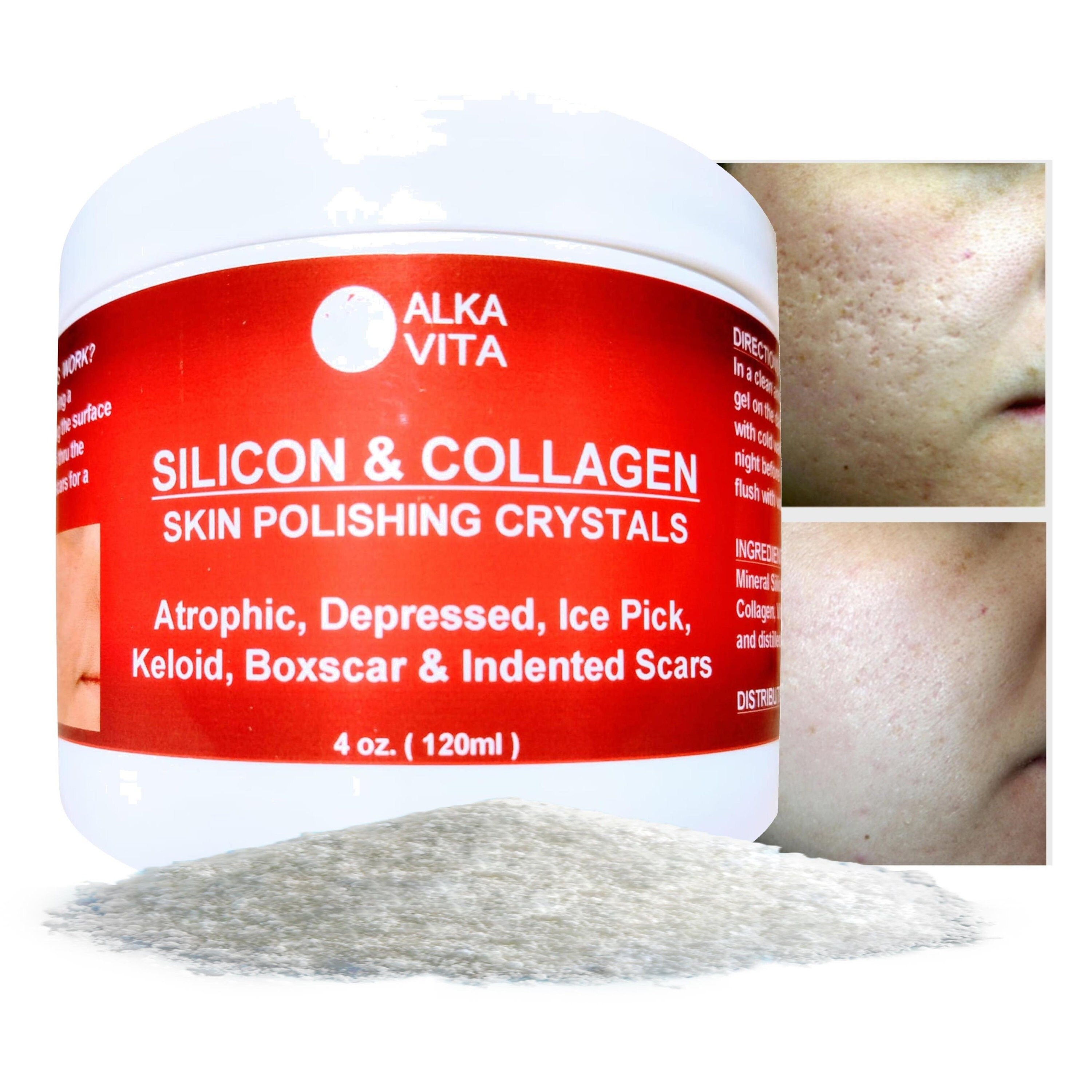 Acne Skin Scars Silicon & Collagen Polishing Crystals Gel for Etsy Canada