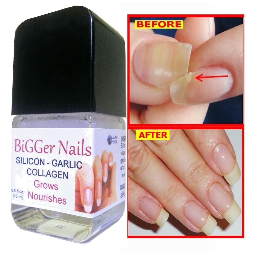 Nail Growth Thickener Gel Silicon Garlic Calcium Collagen & Castor Oil