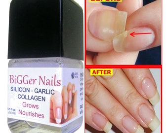 Nail Growth Thickener Gel Silicon Garlic Calcium Collagen & - Etsy Nail Growth Thickener Gel Silicon Garlic Calcium Collagen & - Etsy