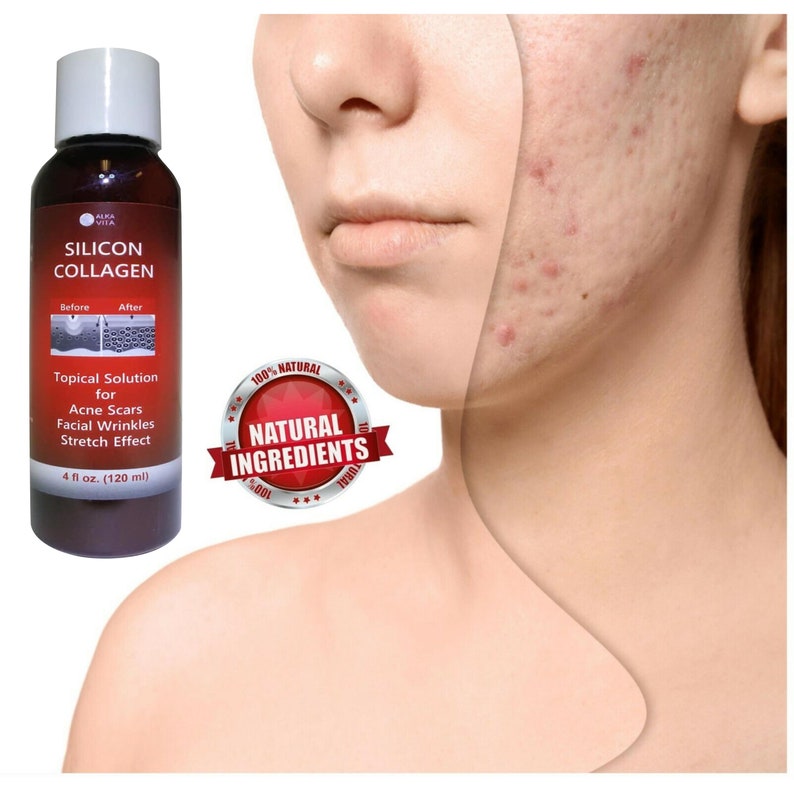Acne Scars Skin Indented Silicon & Collagen Hydrolyzed Facial Etsy