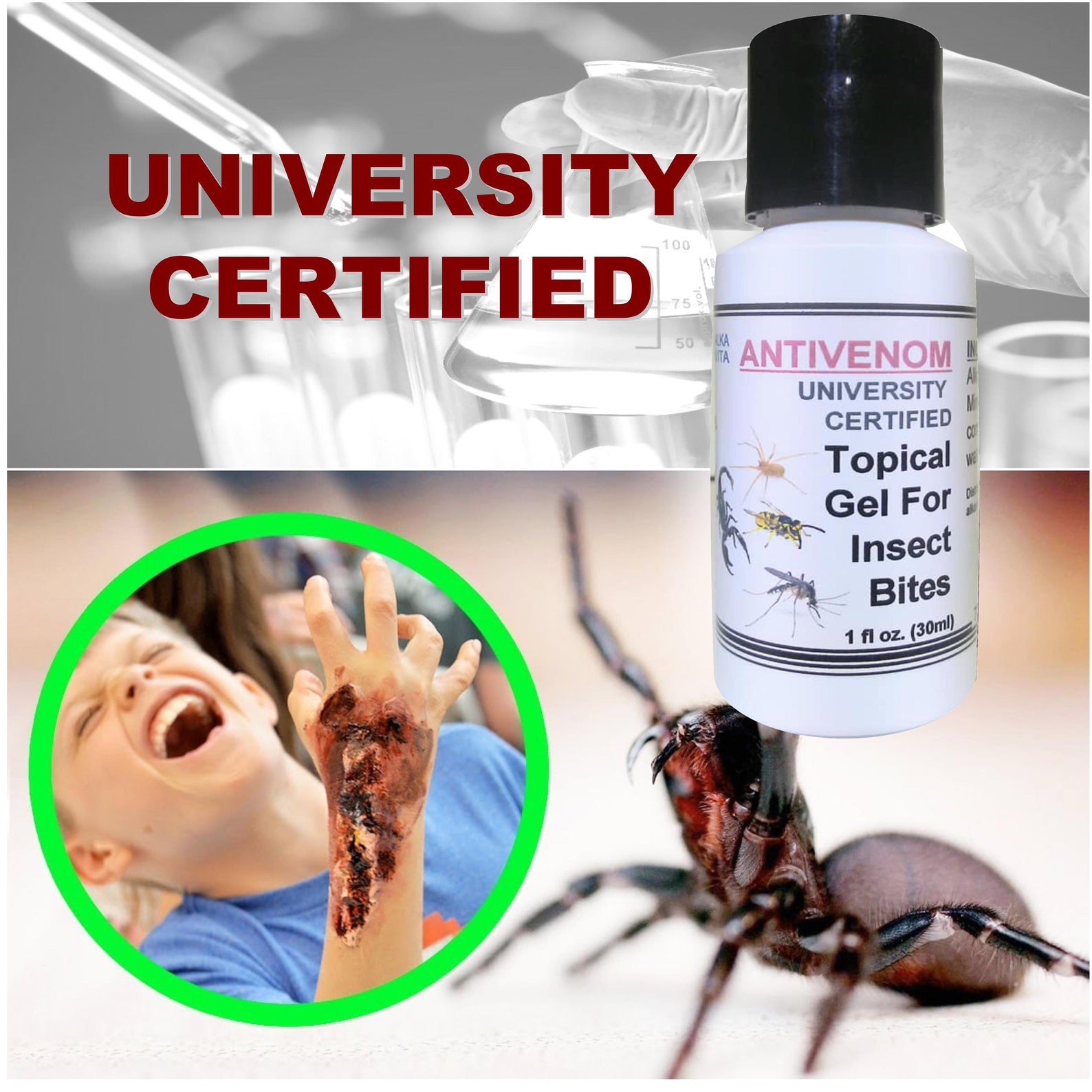 Insect Bites Silica Anti Venom Topical Gel Treatment For Etsy