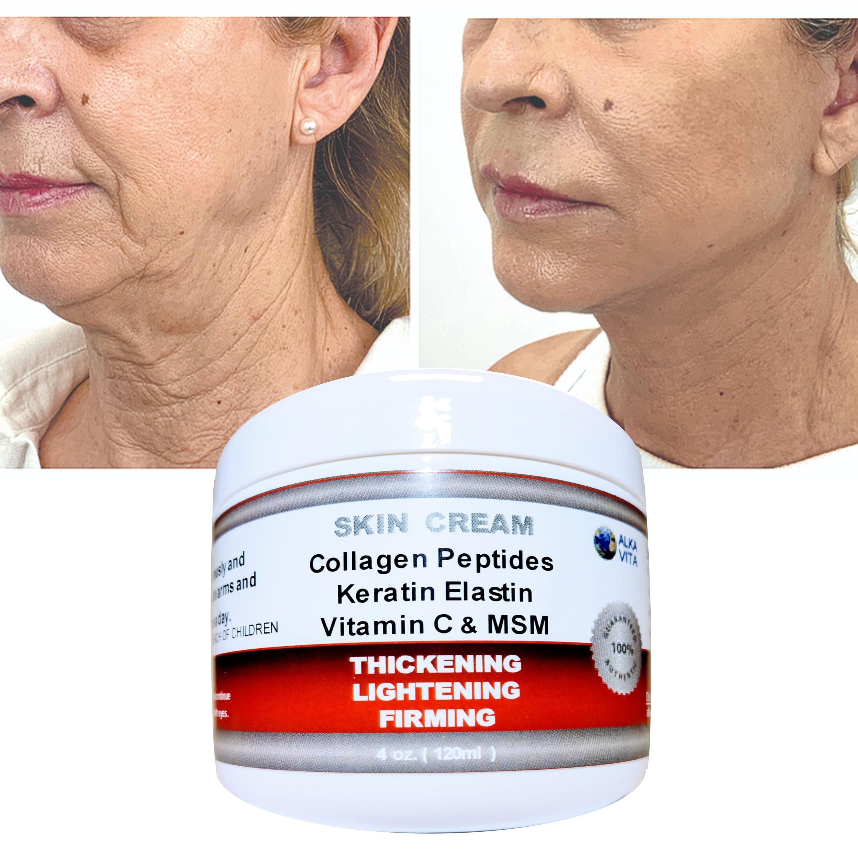 Saggy Skin Arms Hands Firming Thickener Wrinkled Neck Skin Etsy Canada
