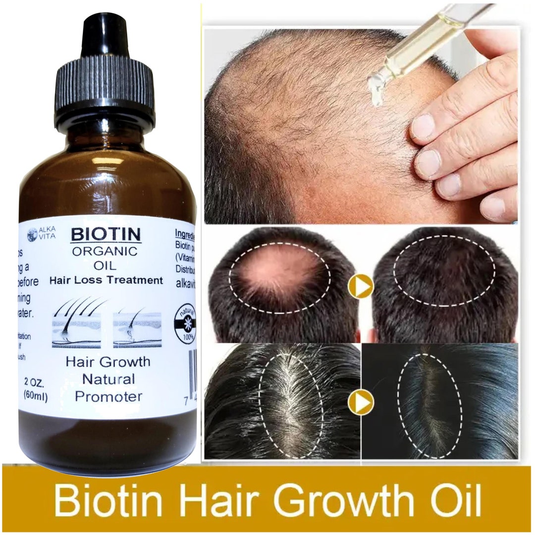 Biotin Hair Loss Topical Organic Pure Oil & Silica Natural Ingredients