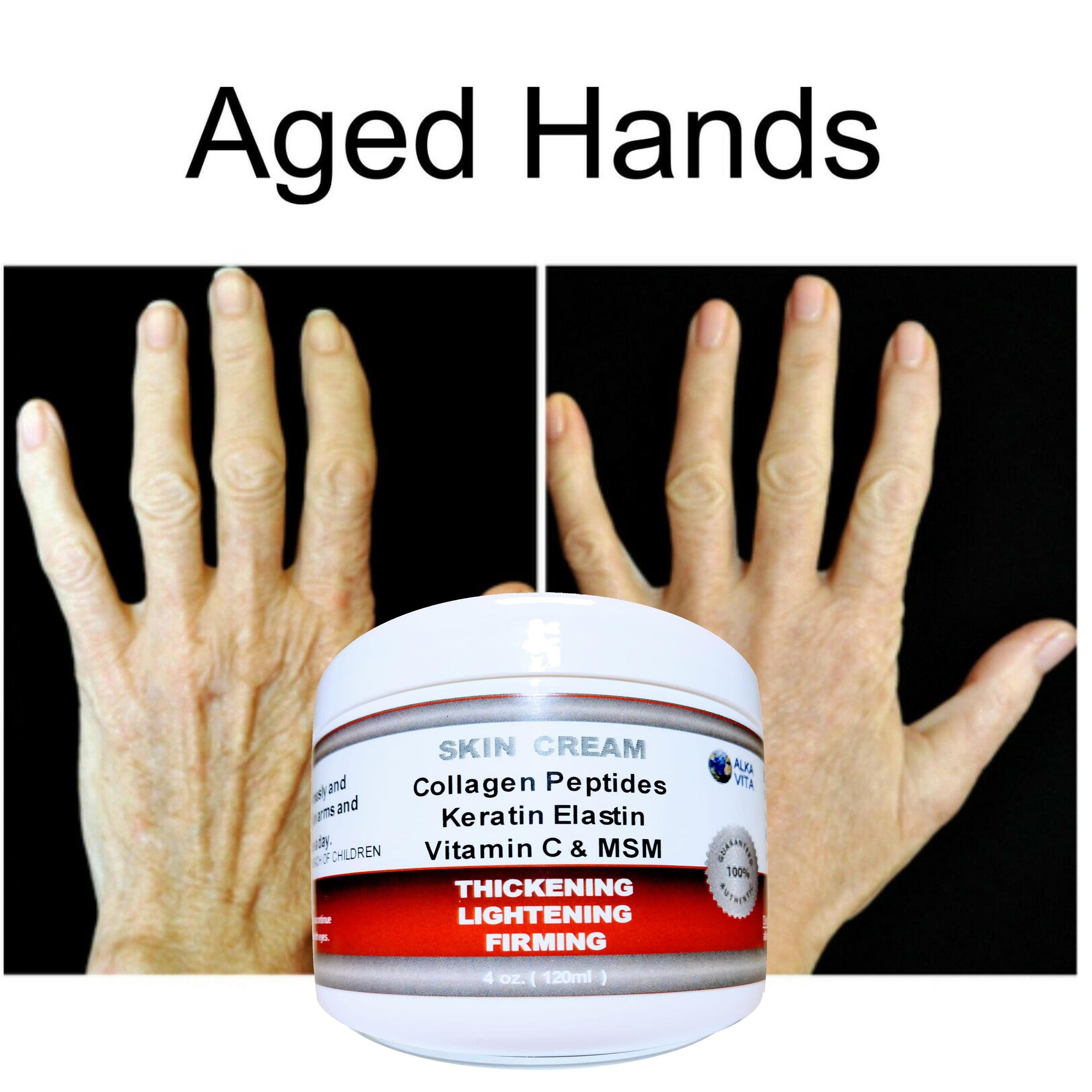 Saggy Skin Arms Hands Firming Thickener Wrinkled Neck Skin Etsy Australia
