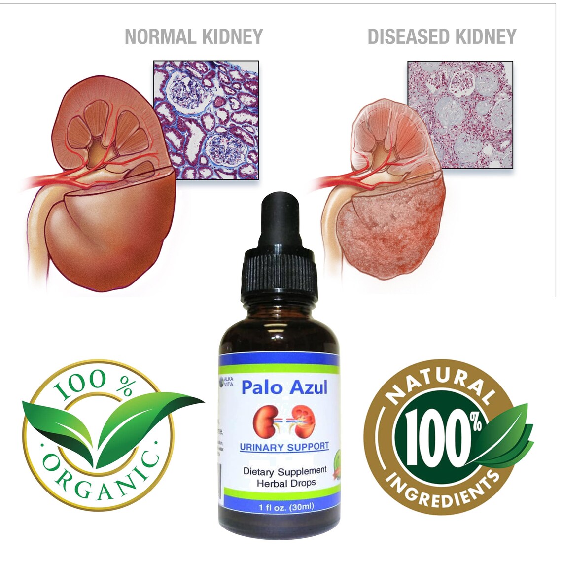 Kidneys Flushing Palo Azul Urinary Cleansing Support Herbal Etsy