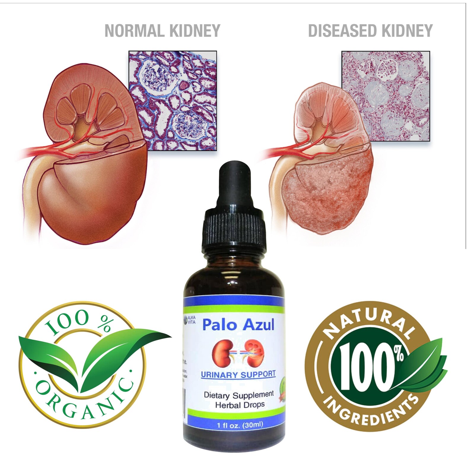Kidneys Flushing Palo Azul Urinary Cleansing Support Herbal Etsy