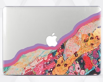 Macbook Pro 16 M2 Colorful Case Cool Macbook Air 13 Inch Case Macbook Pro 13 Inch Art Design Case 15-Inch Macbook Pro Clear Case RD5228