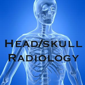 Radiology Notes - Headwork