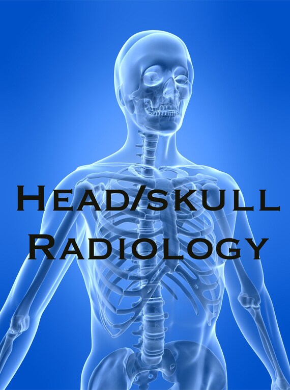 Radiology Notes - Headwork - Etsy