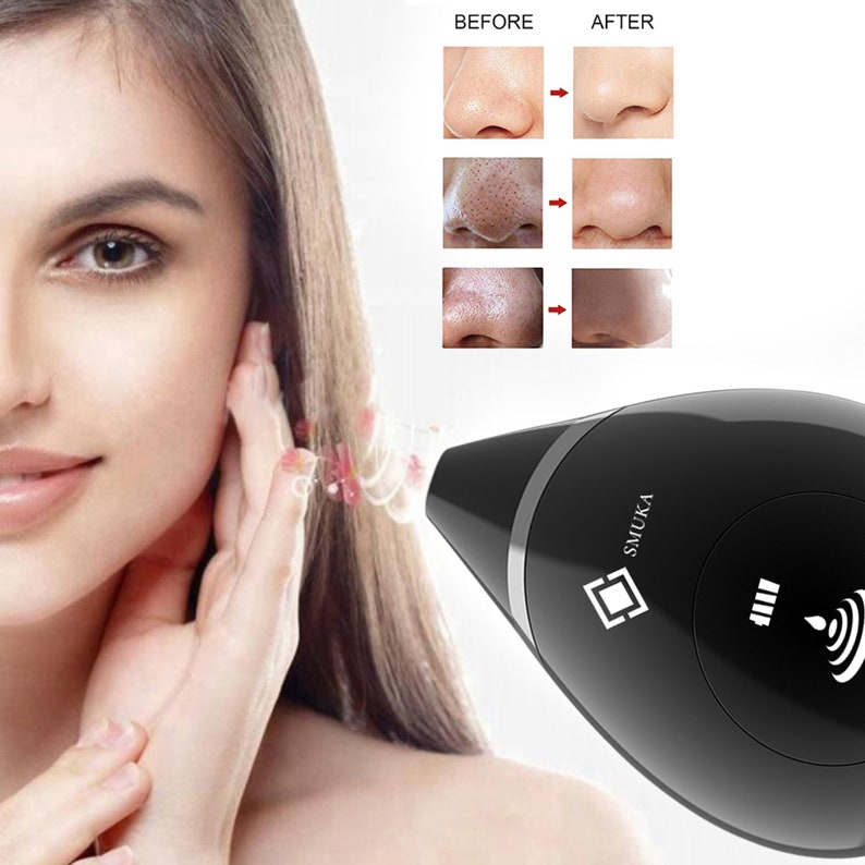 BLACKHEAD REMOVER FACE Exfoliator Anti Aging Device Etsy