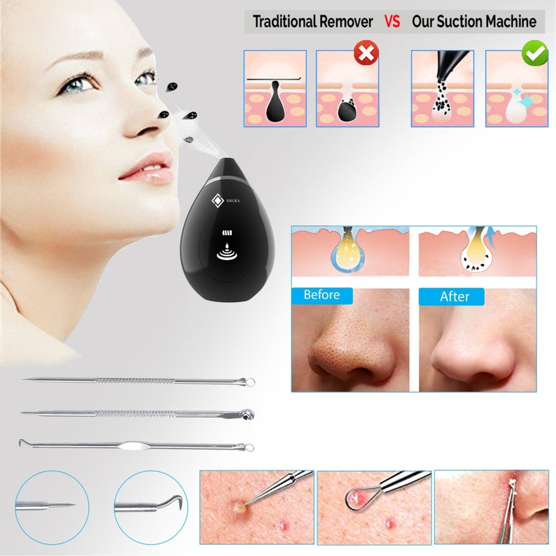 BLACKHEAD REMOVER FACE Exfoliator Anti Aging Device Etsy
