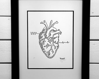 Anatomical Heart Line Art Print – Signed, Numbered Cardiac Wall Art (8.5x11")