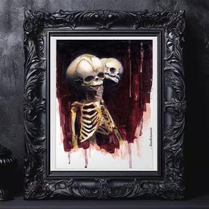 Inseparable - Giclee Art Print Siamese skeleton twins skull art print fetal skull, gothic painting, gothic art print dark art baby skull art