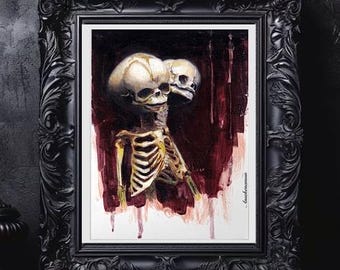 Inseparable - Giclee Art Print Siamese skeleton twins skull art print fetal skull, gothic painting, gothic art print dark art baby skull art