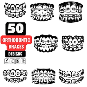 Puede incluir: Gráfico en blanco y negro con 50 diseños de aparatos de ortodoncia. Los diseños incluyen varios estilos de aparatos, con el número 50 en un cuadro negro encima de una pancarta roja que dice "ORTHODONTIC BRACES DESIGNS".