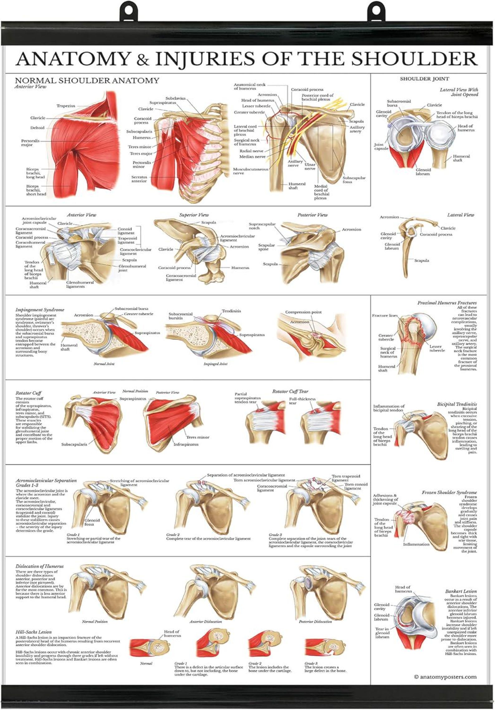 Anatomia E Lesioni Della Spalla – Poster Anatomico 50x66 Cm, Carta Pesante, Illustrazioni Dettagliate, Made In USA