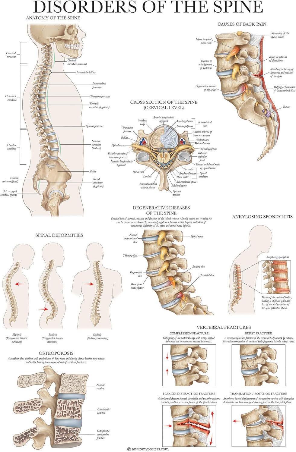 2 Pack: Spinal and Cranial Nerves + Disorders of the Spine Poster Set ...
