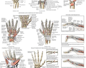 Laminated Anatomy and Injuries of the Hand and Wrist Poster - Hand and Wrist Joint Anatomical Chart - 18" x 24"