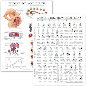 May include: A colorful chart illustrating different labor and birthing positions for pregnant people. The chart is divided into sections for contractions, pushing, water tub, epidural, and problem solving. Each section shows various positions with illustrations of people in each position.