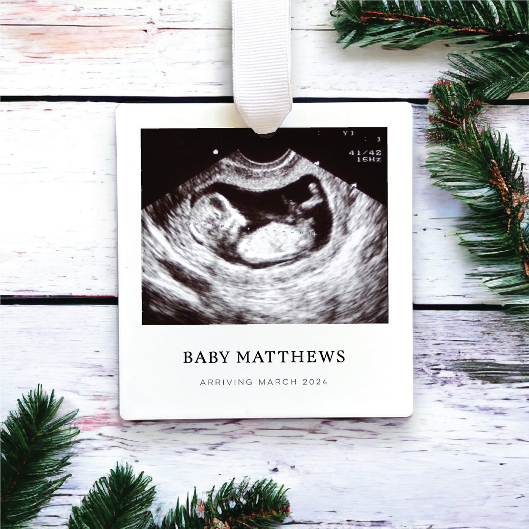 Ultrasound Ornament Sonogram Ornament Baby's First Christmas 2023/2024