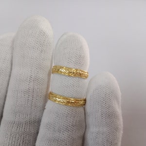 Arthritis Ring, Unique Arthritis Finger Ring, Adjustable Ring, Splint Knuckle Ring, Rose Gold Thumb Ring, Stacking Ring, Gift For Her, Rings