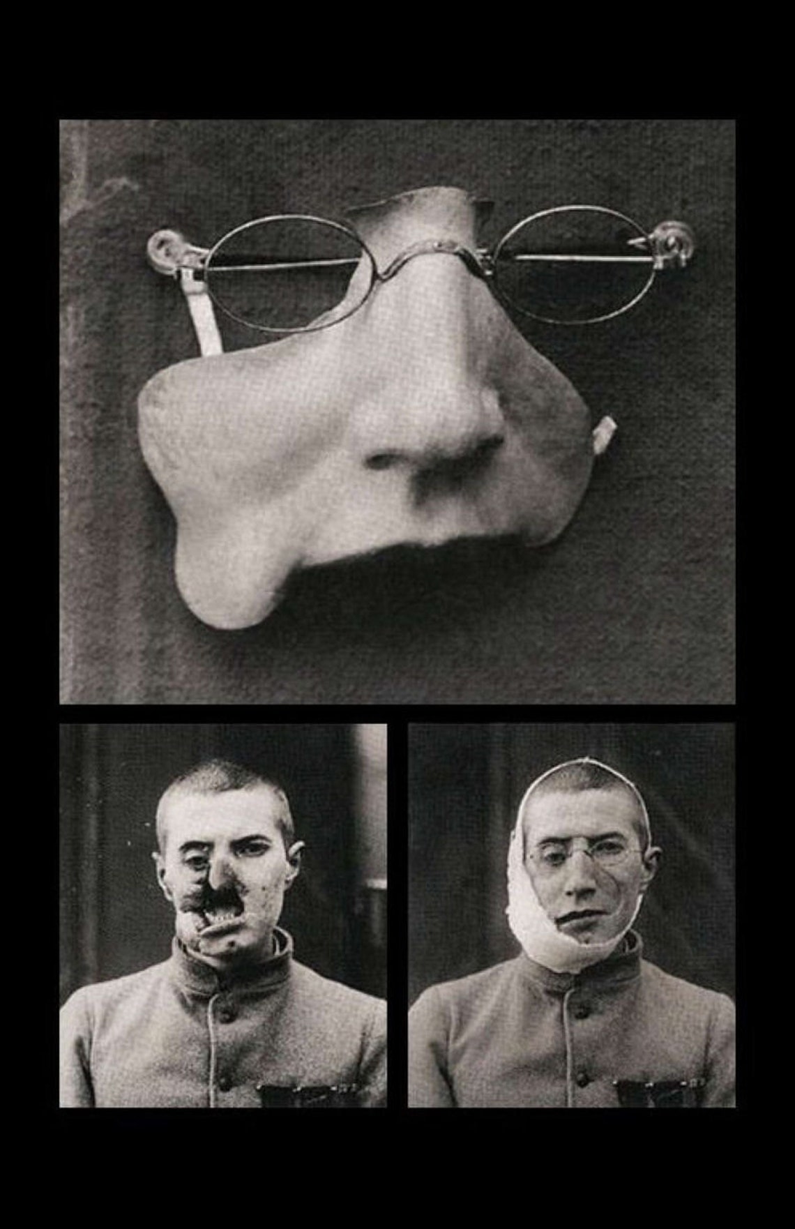 Victorian Era Human Oddities Print Man with a Prosthetic Etsy