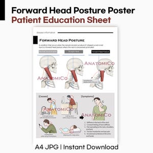 Puede incluir: Un póster blanco titulado "Forward Head Posture Poster Patient Education Sheet". El póster incluye diagramas anatómicos del cuello y la columna vertebral, que ilustran la postura normal, recta y hacia adelante de la cabeza. También enumera causas y síntomas.