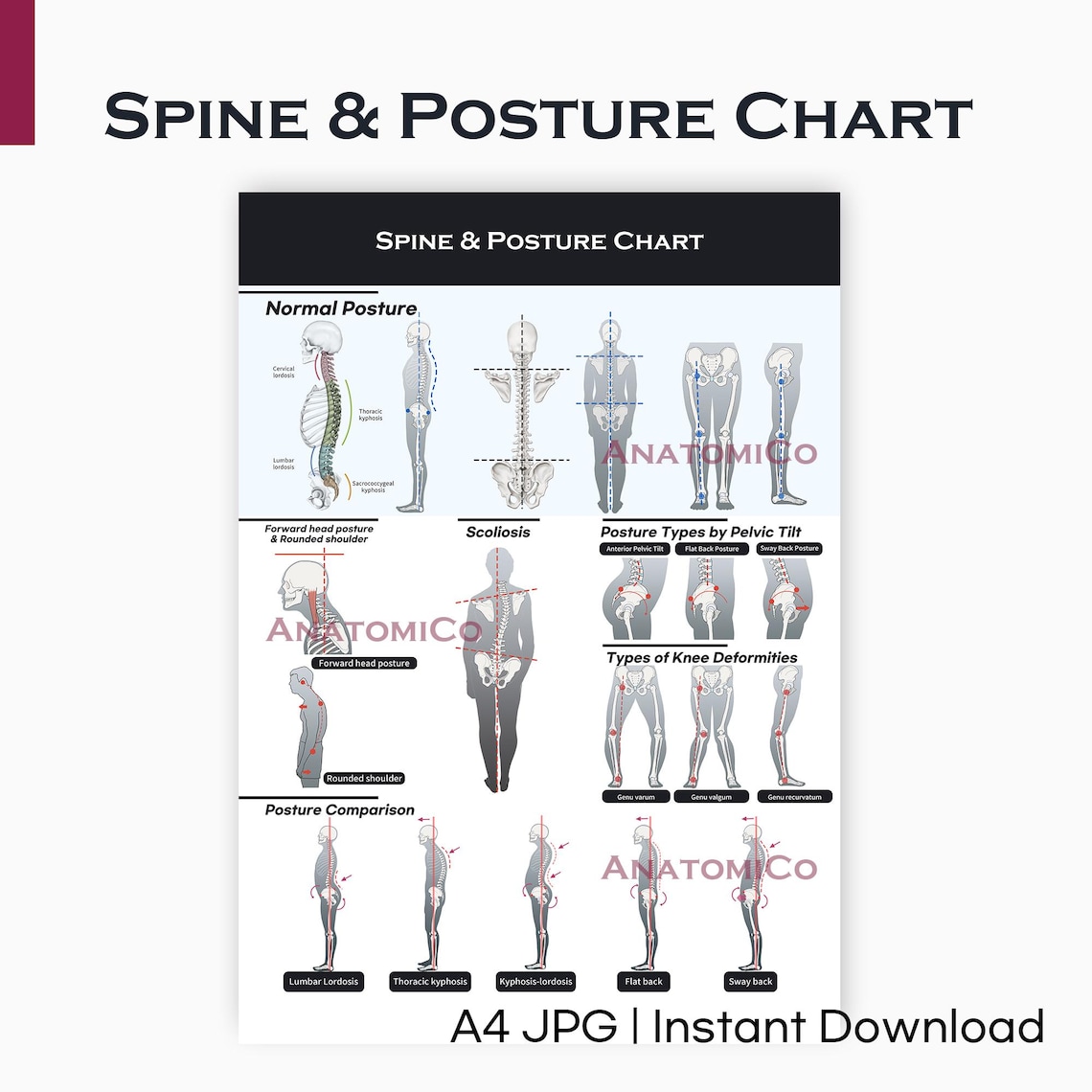 Spine & Posture Chart: Anatomy Poster for Chiropractic, Physical ...