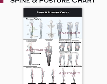 Spine & Posture Chart: Anatomy Poster for Chiropractic, Physical Therapy (A4 JPG)
