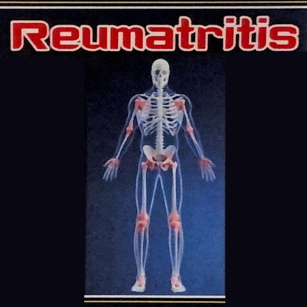 Reumatritis Original