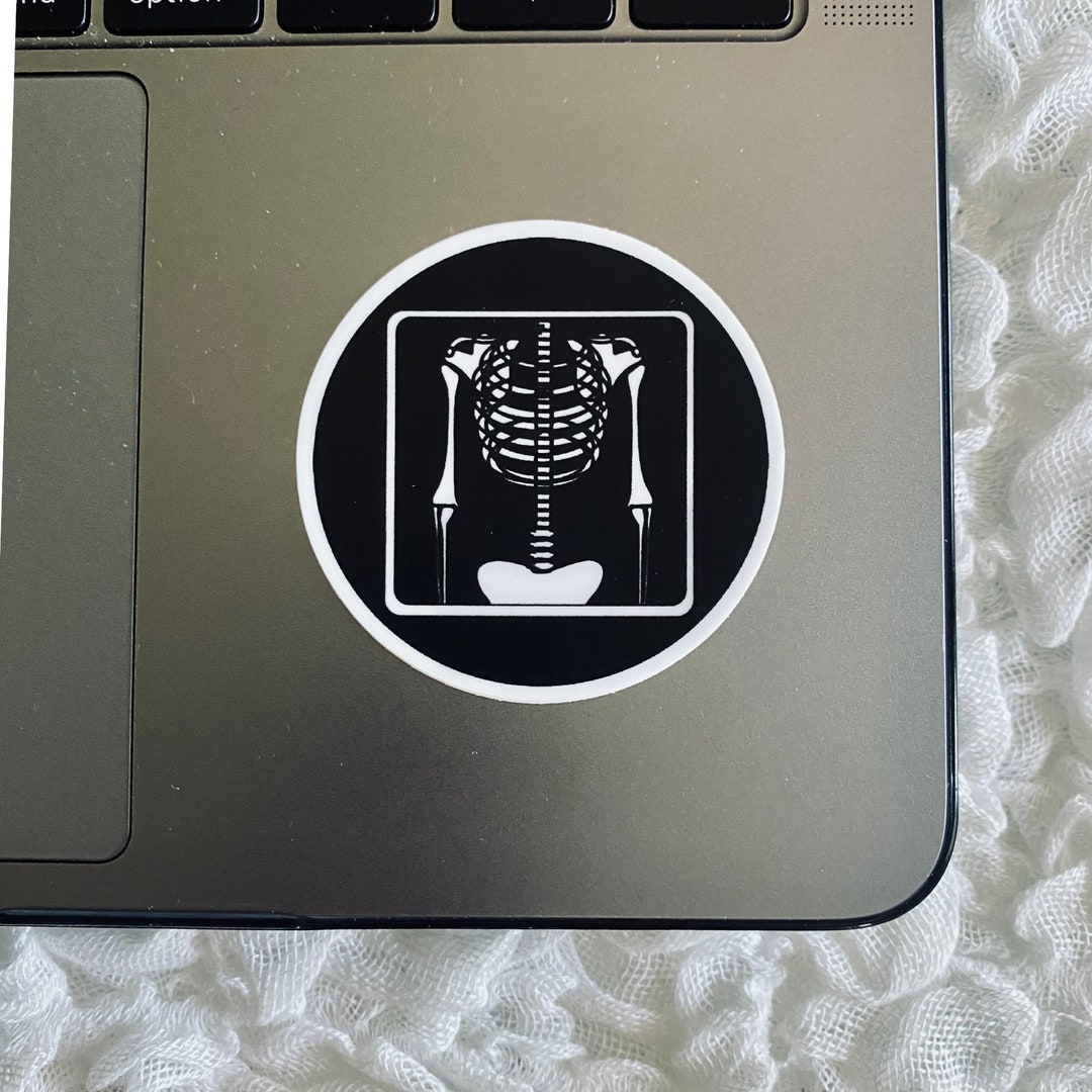 Black X-ray Sticker: Radiology Tech Gift - Etsy