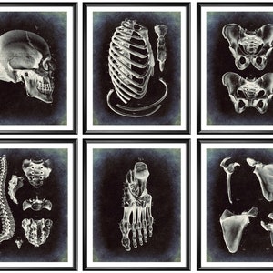 May include: Set of six vintage anatomical illustrations of the human skeleton. The illustrations are in black and white and feature a skull, rib cage, pelvis, spine, foot, and shoulder.