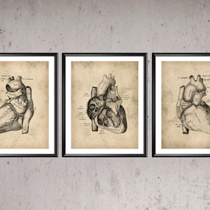 Vintage Anatomie Poster Kardiologie Kunst Anatomisches Herz Kunst Medizinische Dekor Klinik Wand Kunst Chirurg Geschenk Kardiologe Geschenk Arzt Büro Geschenk