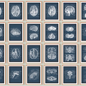 Op de afbeelding: Een set van 24 vintage anatomische illustraties van de menselijke hersenen, gedrukt op een blauwe achtergrond. De illustraties zijn in zwart-wit en tonen verschillende aanzichten van de hersenen, waaronder de frontale, sagittale en axiale aanzichten.